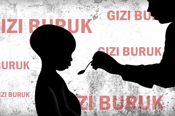 Kasus gizi buruk di Simelue 12 anak