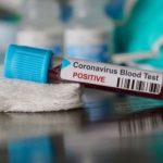 Korea Selatan Bantu Indonesia Alat PCR, Bisa Periksa 32.200 Pasien Corona
