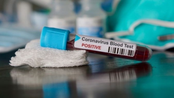 Korea Selatan Bantu Indonesia Alat PCR, Bisa Periksa 32.200 Pasien Corona