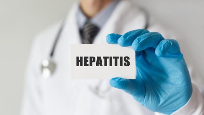 Aceh waspadai penularan hepatitis akut misterius