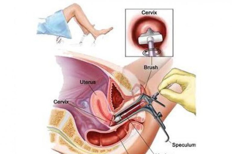 Dokter sebut terapi target membuat sel kanker jadi mudah dikendalikan