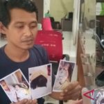 Perawat di Palembang gunting jari bayi hingga putus