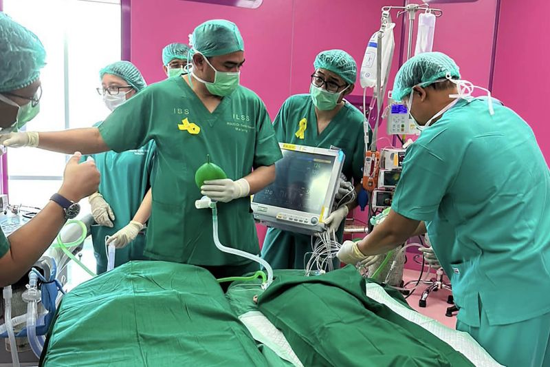Tim dokter berhasil pisahkan bayi kembar siam Aisyah dan Aliyah