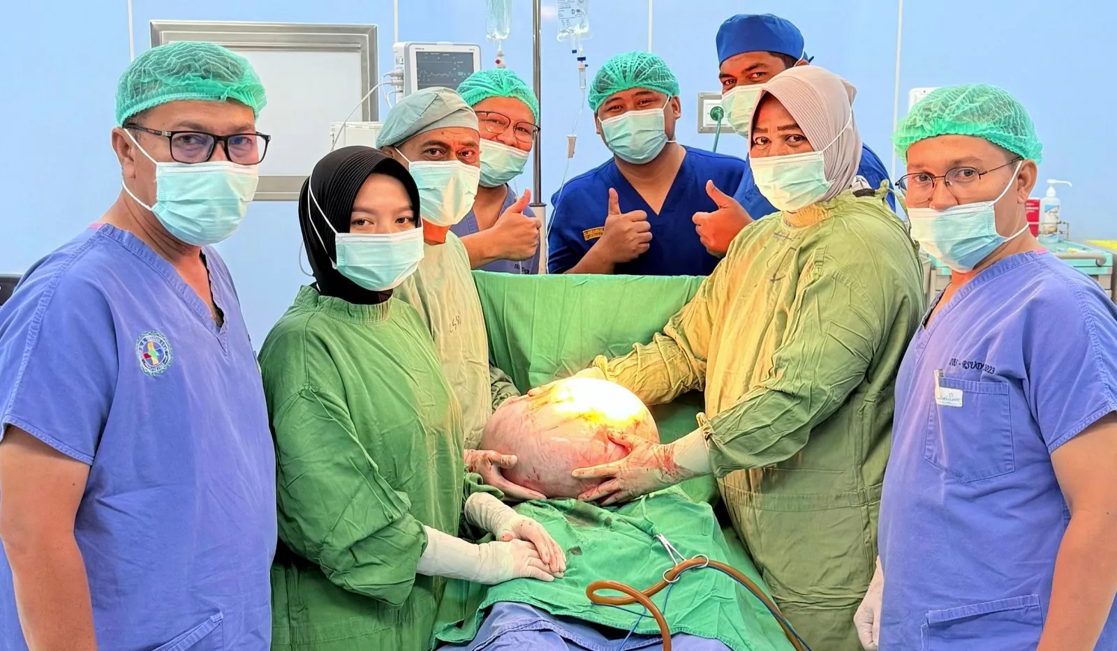 Kasus medis langkah, kista ovarium19 kilogram, berhasil diangkat tim dokter di rumah sakit Abdya